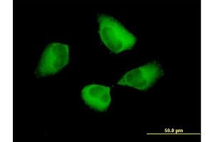 Immunofluorescence of purified MaxPab antibody to PDCD6IP on HeLa cell. (ALIX Antikörper  (AA 1-868))