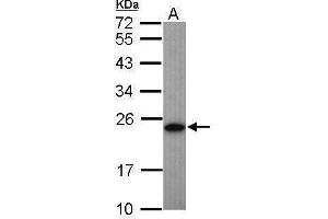 WB Image Sample (50 ug of whole cell lysate) A: Mouse brown adipose tissue 12% SDS PAGE antibody diluted at 1:1000 (Adenylate Kinase 1 Antikörper)