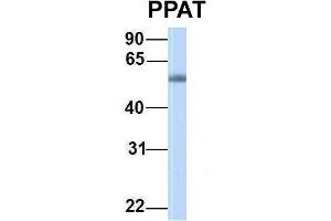 Host:  Rabbit  Target Name:  PPAT  Sample Type:  Human Fetal Muscle  Antibody Dilution:  1.