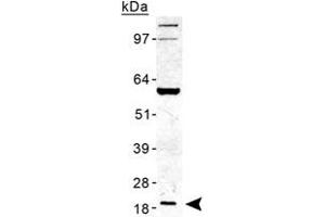 Western blot analysis of TMED10 in human liver lysate with TMED10 polyclonal antibody . (TMED10 Antikörper  (AA 100-200))