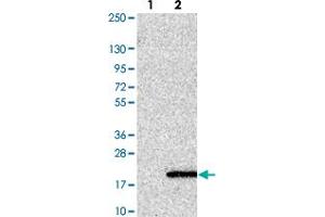 Western blot analysis of Lane 1: Negative control (vector only transfected HEK293T lysate). (UFSP1 Antikörper)