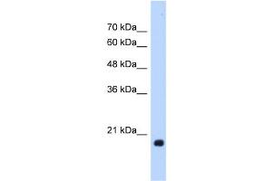 WB Suggested Anti-HSPB6 Antibody Titration:  1. (HSPB6 Antikörper  (Middle Region))