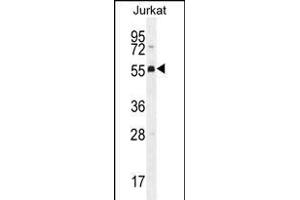 PODNL1 Antibody (Center) (ABIN656141 and ABIN2845479) western blot analysis in Jurkat cell line lysates (35 μg/lane). (PODNL1 Antikörper  (AA 167-195))