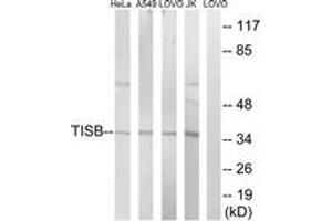 Western blot analysis of extracts from Jurkat/HeLa/A549/LOVO cells, using TISB (Ab-92) Antibody. (ZFP36L1 Antikörper  (AA 58-107))