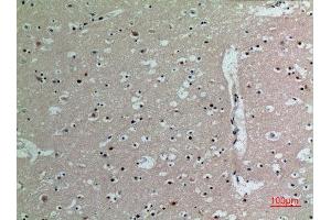 Immunohistochemistry (IHC) analysis of paraffin-embedded Human Brain, antibody was diluted at 1:100. (IL16 Antikörper  (C-Term))
