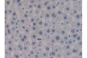 IHC-P analysis of Rat Liver Tissue, with DAB staining. (PTPRJ Antikörper  (AA 1033-1277))