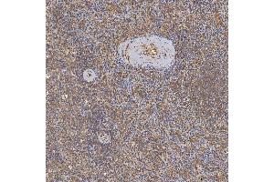 IHC analysis of SFXN3 using anti-SFXN3 antibody (ABIN7601302). (SFXN3 Antikörper  (AA 32-321))