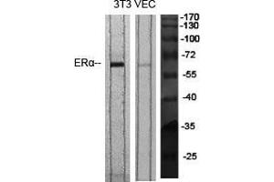 Western Blot (WB) analysis of specific cells using ERalpha Polyclonal Antibody. (Estrogen Receptor alpha Antikörper  (Ser364))