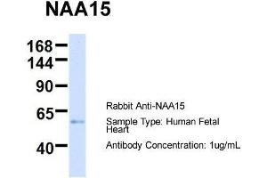 Host:  Rabbit  Target Name:  NAA15  Sample Type:  Human Fetal Heart  Antibody Dilution:  1. (NAA15 Antikörper  (N-Term))