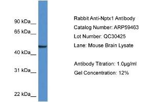 Western Blotting (WB) image for anti-Neuronal Pentraxin 1 (NPX1) (Middle Region) antibody (ABIN2788076) (NPX1 Antikörper  (Middle Region))