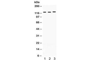 Western blot testing of 1) rat heart, 2) mouse brain, and 3) human A549 lysate with CRM1 antibody. (XPO1 Antikörper)