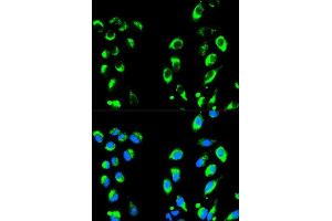 Immunofluorescence analysis of HeLa cell using NFKBIA antibody.