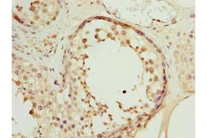 Immunohistochemistry of paraffin-embedded human testis tissue using ABIN7166136 at dilution of 1:100 (CCDC99 Antikörper  (AA 1-300))