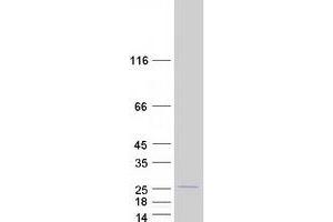Western Blotting (WB) image for Peptidylprolyl Cis/trans Isomerase, NIMA-Interacting 1 (PIN1) protein (Myc-DYKDDDDK Tag) (ABIN2728994)