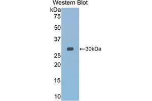 Western blot analysis of the recombinant protein. (GZMK Antikörper  (AA 27-264))