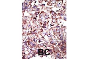 Immunohistochemistry (IHC) image for anti-Farnesyltransferase, CAAX Box, alpha (FNTA) antibody (ABIN3001525) (FNTA Antikörper)