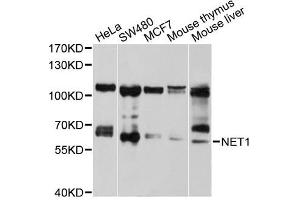 Western blot analysis of extracts of various cell lines, using NET1 antibody (ABIN5970555) at 1/1000 dilution. (NET1 Antikörper)