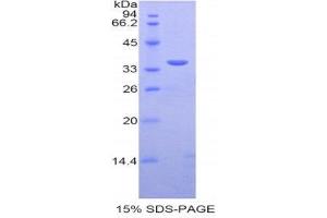 SDS-PAGE (SDS) image for Sulfotransferase Family, Cytosolic, 1A, Phenol-Preferring, Member 1 (SULT1A1) (AA 2-295) protein (His tag) (ABIN2121874)