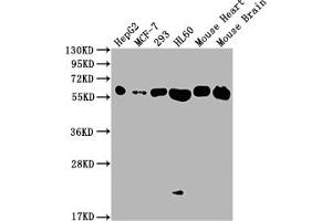 Western Blot Positive WB detected in: HepG2 whole cell lysate, MCF-7 whole cell lysate, 293 whole cell lysate, HL60 whole cell lysate, Mouse Heart tissue, Mouse Brain tissue All lanes: ATP5F1A antibody at 1:2000 Secondary Goat polyclonal to rabbit IgG at 1/50000 dilution Predicted band size: 60, 55, 58 kDa Observed band size: 60 kDa (Rekombinanter ATP5A1 Antikörper)