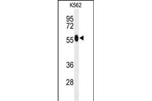 Western blot analysis of ACSM1 Antibody (N-term) (ABIN653232 and ABIN2842765) in K562 cell line lysates (35 μg/lane). (ACSM1 Antikörper  (N-Term))