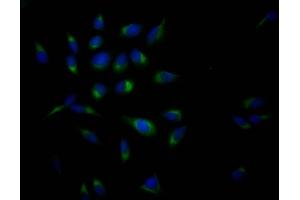 Immunofluorescence (IF) image for anti-Amyloid beta (A4) Precursor Protein (APP) antibody (ABIN7127338)