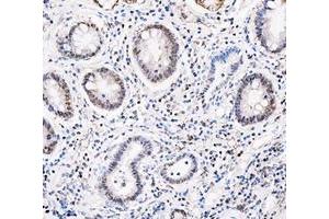 IHC analysis of ADK using anti-ADK antibody (ABIN4886430). (ADK Antikörper  (AA 165-351))