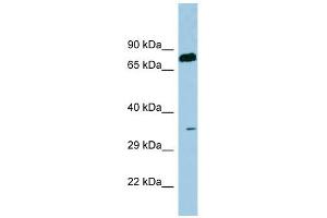 SDS antibody used at 1 ug/ml to detect target protein. (serine Dehydratase Antikörper  (N-Term))