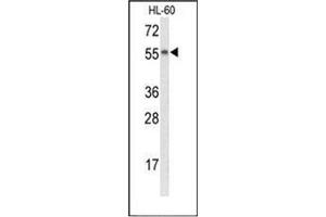 Western blot analysis of Nyctalopin Antibody (N-term) in HL-60 cell line lysates (35ug/lane). (Nyctalopin Antikörper  (N-Term))