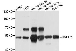 Western blot analysis of extracts of various cell lines, using CNDP2 antibody. (CNDP2 Antikörper)