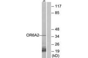 Western blot analysis of extracts from Jurkat cells, using OR6A2 Antibody. (OR6A2 Antikörper  (AA 58-107))