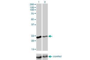 Western blot analysis of RAB4A over-expressed 293 cell line, cotransfected with RAB4A Validated Chimera RNAi (Lane 2) or non-transfected control (Lane 1). (Rab4 Antikörper  (AA 1-218))