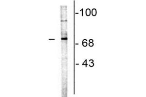 Western Blot of Anti-Choline Acetyltransferase Antibody Western Blot of Goat Anti-Choline Acetyltransferase Antibody.
