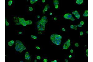 Immunofluorescent staining of HepG2 cells using anti-SORD mouse monoclonal antibody (ABIN2453678). (SORD Antikörper)