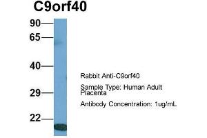 Host: Rabbit  Target Name: C9orf40  Sample Tissue: Human Adult Placenta  Antibody Dilution: 1. (C9orf40 Antikörper  (Middle Region))