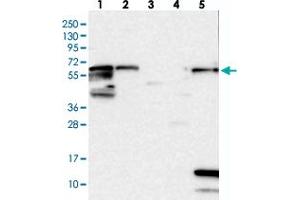 Western blot analysis of Lane 1: RT-4, Lane 2: U-251 MG, Lane 3: Human Plasma, Lane 4: Liver, Lane 5: Tonsil with ME3 polyclonal antibody . (ME3 Antikörper)