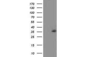 Western Blotting (WB) image for anti-Nudix (Nucleoside Diphosphate Linked Moiety X)-Type Motif 6 (NUDT6) antibody (ABIN1499871) (NUDT6 Antikörper)