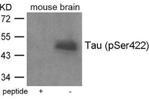 Western blot analysis of extracts from mouse brain tissue using Tau(Phospho-Ser422) Antibody and the same antibody preincubated with blocking peptide. (MAPT Antikörper  (pSer422))