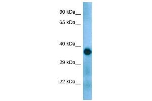 Host:  Rabbit  Target Name:  Gapdh  Sample Type:  Mouse Muscle lysates  Antibody Dilution:  1.
