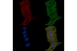 ABIN6265360 and ABIN6276804 staining Hela cells(24h of starvation treatment) by IF/ICC.