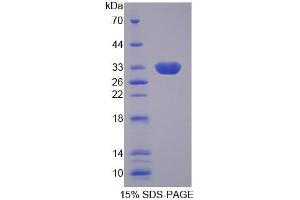 SDS-PAGE analysis of Human SLC25A13 Protein. (slc25a13 Protein)