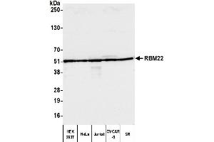 Western Blotting (WB) image for anti-RNA Binding Motif Protein 22 (RBM22) (AA 175-225) antibody (ABIN7449905) (RBM22 Antikörper  (AA 175-225))