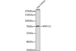 Western blot analysis of extracts of Rat kidney, using RNF112 antibody (ABIN7270054) at 1:1000 dilution. (RNF112 Antikörper  (AA 200-500))