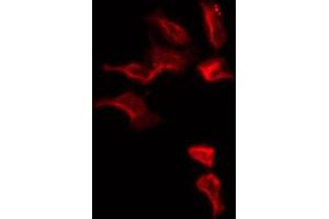 ABIN6274813 staining HepG2 by IF/ICC. (SLC25A6 Antikörper  (Internal Region))