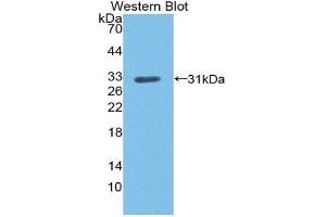 Western Blotting (WB) image for anti-Low Density Lipoprotein Receptor (LDLR) (AA 497-742) antibody (ABIN1868939) (LDLR Antikörper  (AA 497-742))