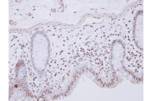 IHC-P Image RCL1 antibody [N1C3] detects RCL1 protein at nucleus on human normal colon by immunohistochemical analysis. (RCL1 Antikörper)