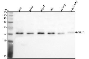 Western blot analysis of POLR1D using anti-POLR1D antibody (ABIN7599585).