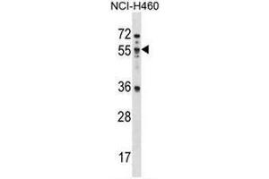 MEX3B Antibody (N-term) western blot analysis in NCI-H460 cell line lysates (35µg/lane). (MEX3B Antikörper  (N-Term))