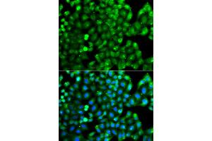 Immunofluorescence analysis of A549 cells using HLA-DRB1 antibody.