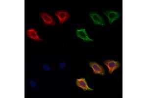 ABIN6256906 and ABIN6274857 staining Hela cells by IF/ICC. (Apolipoprotein L 2 Antikörper  (C-Term))