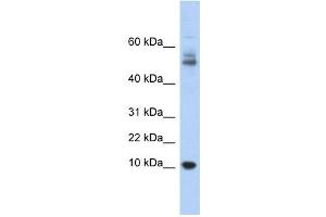 Myotrophin antibody used at 1 ug/ml to detect target protein.